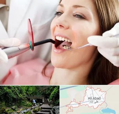 متخصص درمان ریشه دندان در علی آباد کتول