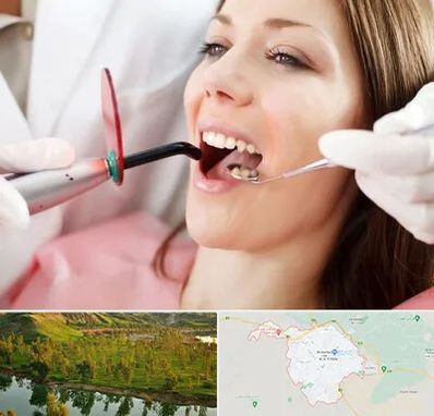 متخصص درمان ریشه دندان در بهبهان