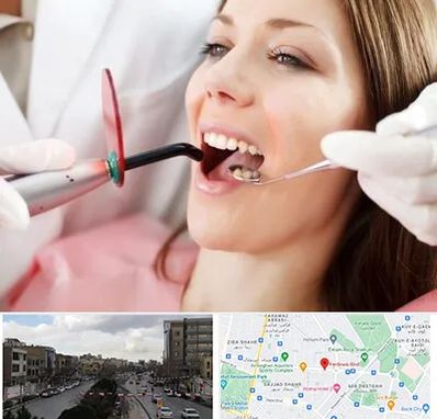 متخصص درمان ریشه دندان در بلوار فردوسی مشهد