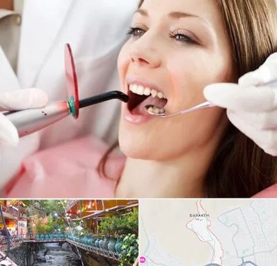 متخصص درمان ریشه دندان در درکه