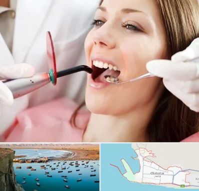 متخصص درمان ریشه دندان در چابهار