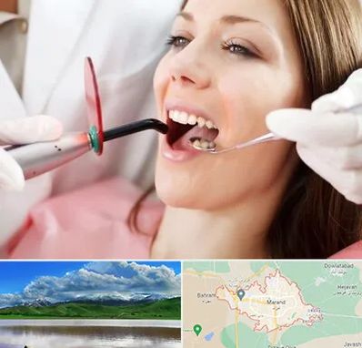 متخصص درمان ریشه دندان در مرند