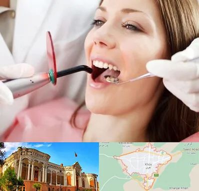 متخصص درمان ریشه دندان در خوی