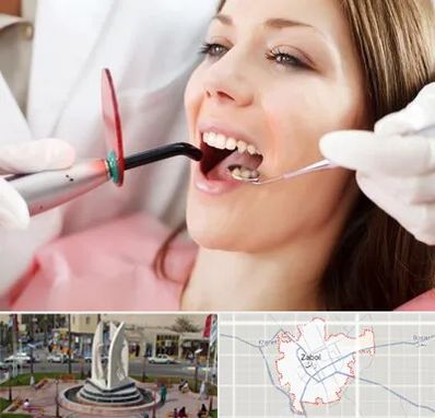 متخصص درمان ریشه دندان در زابل