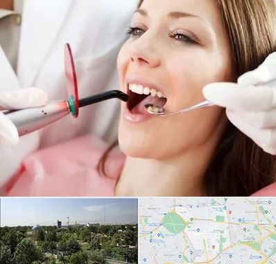 متخصص درمان ریشه دندان در منطقه 16 تهران