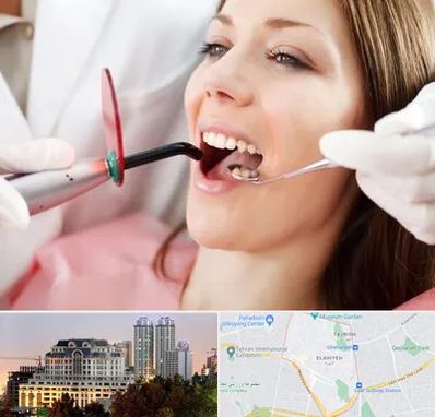 متخصص درمان ریشه دندان در فرشته 