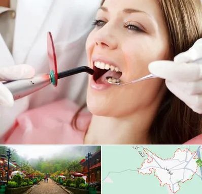 متخصص درمان ریشه دندان در فومن