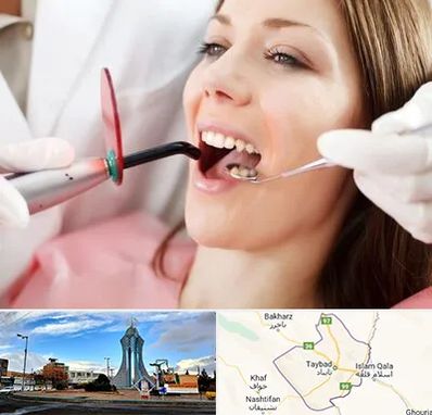 متخصص درمان ریشه دندان در تایباد