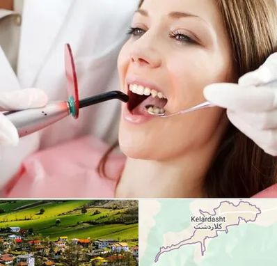 متخصص درمان ریشه دندان در کلاردشت