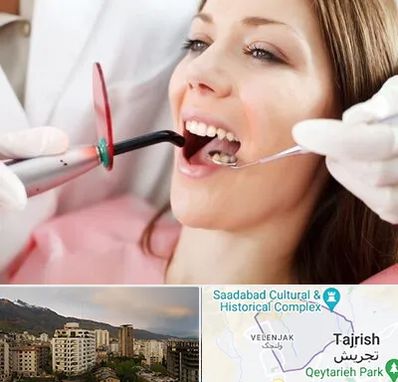 متخصص درمان ریشه دندان در زعفرانیه 