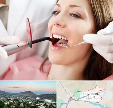 متخصص درمان ریشه دندان در لواسان
