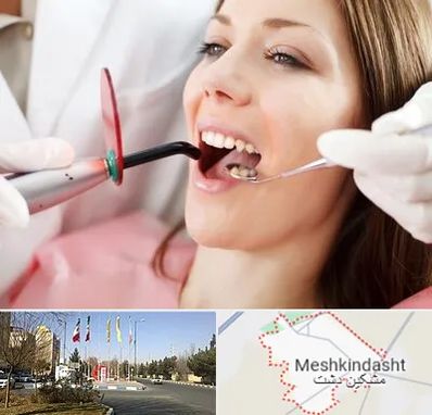 متخصص درمان ریشه دندان در مشکین دشت