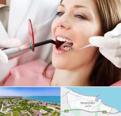 متخصص درمان ریشه دندان در نوشهر