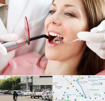 متخصص درمان ریشه دندان در قدوسی شرقی شیراز
