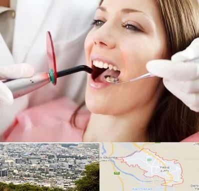 متخصص درمان ریشه دندان در یاسوج