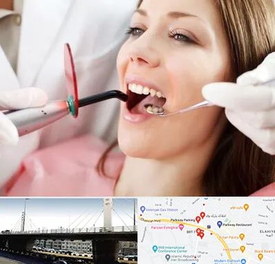 متخصص درمان ریشه دندان در پارک وی 