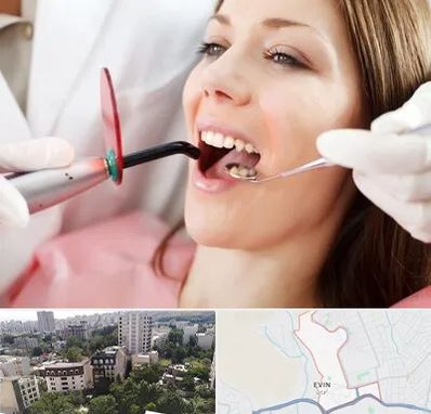 متخصص درمان ریشه دندان در اوین