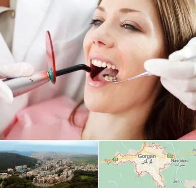 متخصص درمان ریشه دندان در گرگان