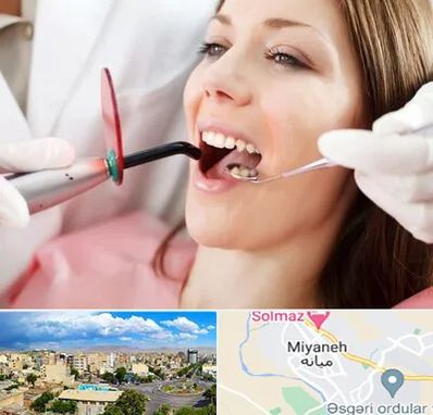 متخصص درمان ریشه دندان در میانه