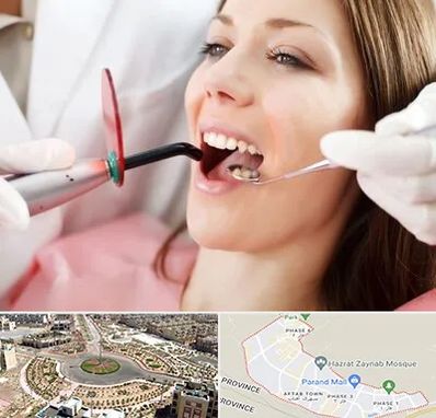 متخصص درمان ریشه دندان در پرند