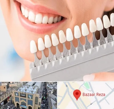 متخصص لمینت دندان در بازار رضا مشهد