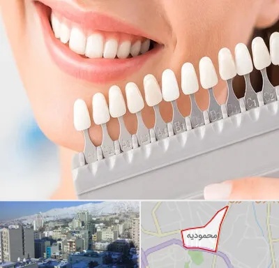 متخصص لمینت دندان در محمودیه
