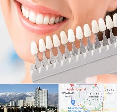 متخصص لمینت دندان در شهرک غرب 