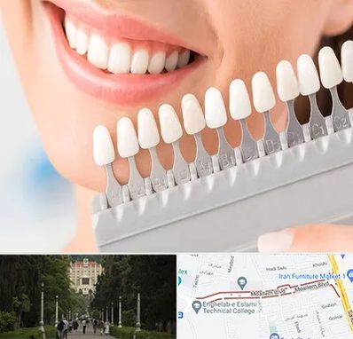 متخصص لمینت دندان در بلوار معلم رشت 