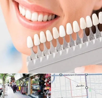 متخصص لمینت دندان در سلسبیل