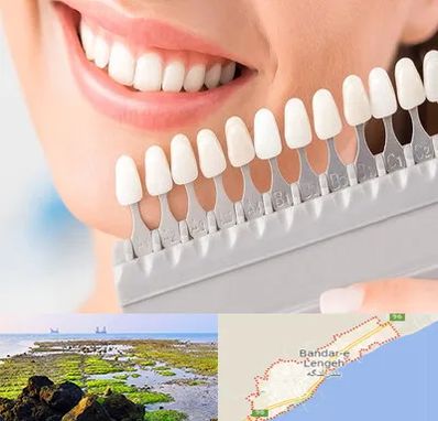 متخصص لمینت دندان در بندرلنگه