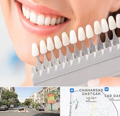 متخصص لمینت دندان در چهارصد دستگاه 