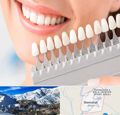 متخصص لمینت دندان در شمشک