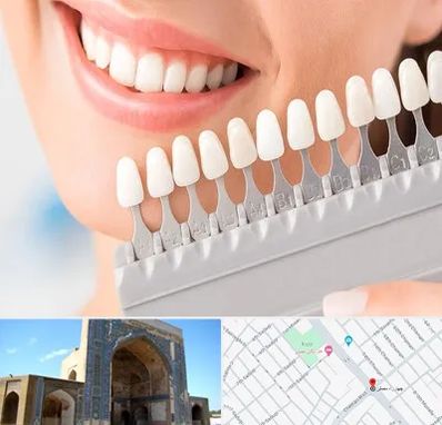 متخصص لمینت دندان در مصلی مشهد