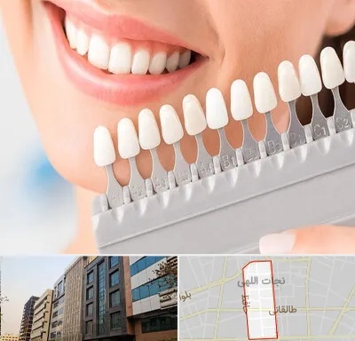 متخصص لمینت دندان در نجات اللهی