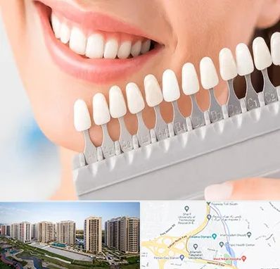 متخصص لمینت دندان در المپیک 