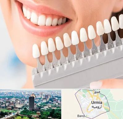 متخصص لمینت دندان در ارومیه