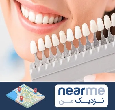 متخصص لمینت دندان در نزدیک من