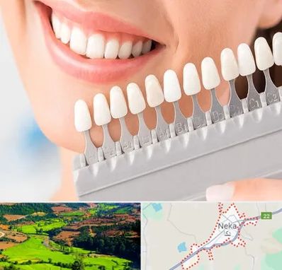 متخصص لمینت دندان در نکا