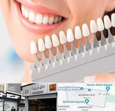 متخصص لمینت دندان در منیریه 