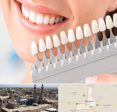 متخصص لمینت دندان در سبزوار