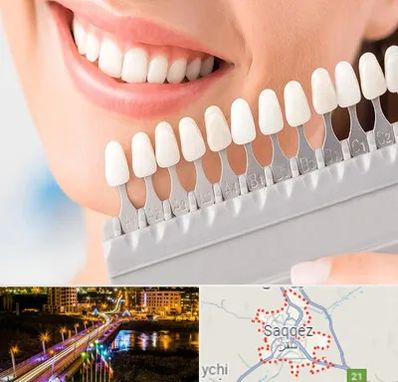 متخصص لمینت دندان در سقز