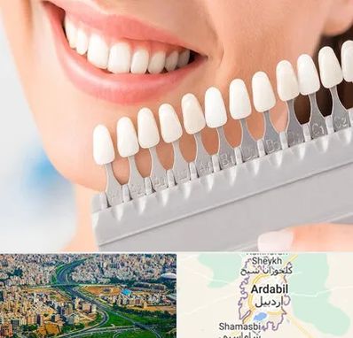 متخصص لمینت دندان در اردبیل