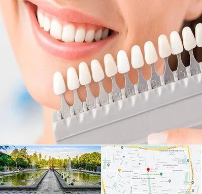 متخصص لمینت دندان در سرسبز