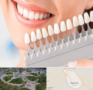 متخصص لمینت دندان در ورامین