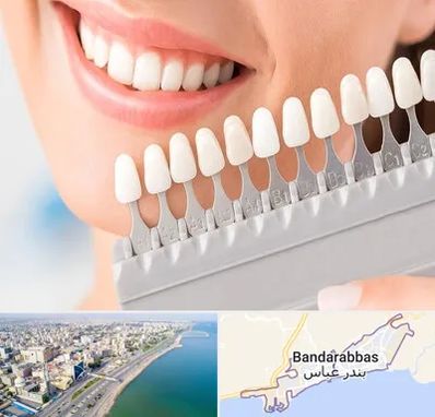 متخصص لمینت دندان در بندرعباس