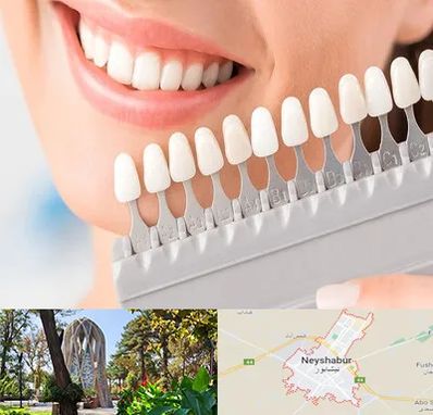 متخصص لمینت دندان در نیشابور