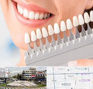 متخصص لمینت دندان در مرکز تهران
