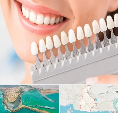 متخصص لمینت دندان در سیستان و بلوچستان