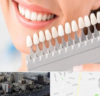 متخصص لمینت دندان در زرتشت