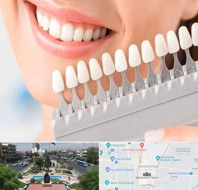 متخصص لمینت دندان در بهارستان 